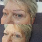 Microblading-June-8th175